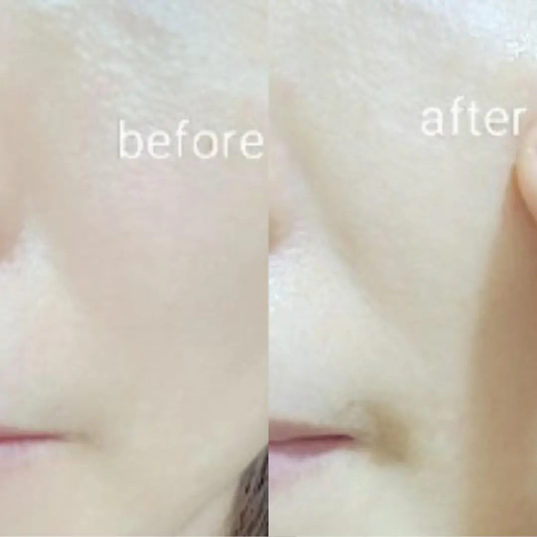 Calm Cocoon • Soothing Sheet Mask